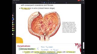 RRSrenal parasitology [upl. by Oirotciv372]