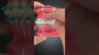 How to use Ortho Wax [upl. by Nohtanoj]