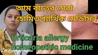 আমবাত চর্ম এ‍্যালার্জীর হোমিওপ্যাথি ঔষধ। Homeopathic medicine for urticaria [upl. by Jaunita]