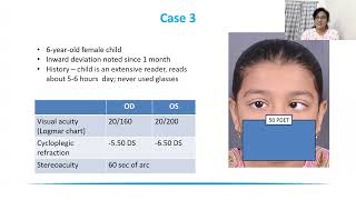 Lecture Acquired Esotropia – What’s New in 2023 [upl. by Cire]