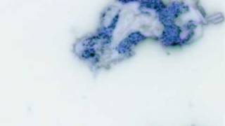 Phagocytosis White blood cell Shigella bacteria Live movie [upl. by Zerline]