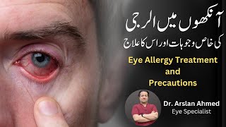 Eye Allergy Treatment and Precautions in Urdu Hindi [upl. by Adnuahsar]