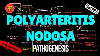 POLYARTERITIS NODOSA Pathogenesis Mechanism of Clinical symptoms Treatment [upl. by Eckhardt]