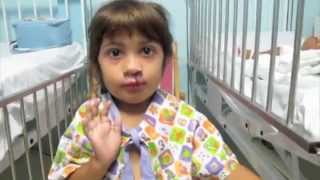 After cleft lip surgery a little girl sees new face for the first timeflv [upl. by Bay177]