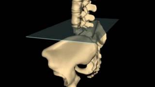 Posterior Innominate Rotation [upl. by Nana]