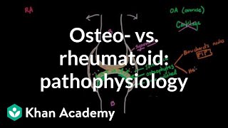 Osteoarthritis vs rheumatoid arthritis pathophysiology  NCLEXRN  Khan Academy [upl. by Jessamyn]