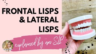 FRONTAL LISP VS LATERAL LISP explained by an SLP [upl. by Harday]