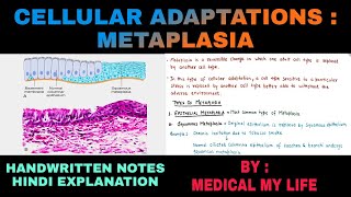 Cellular Adaptations  2  Metaplasia  Pathology [upl. by Dazhahs]