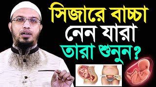 মহিলাদের সিজারে বাচ্চা হলে কি হয় অধিকাংশ মানুষ জানেই না শায়খ আহমাদুল্লাহ [upl. by Adnahc492]