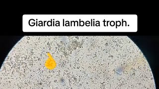 Giardia lambelia trophozoite stooltest stool Stoolexam stoolanalysis stoolexamination gse [upl. by Yoj]