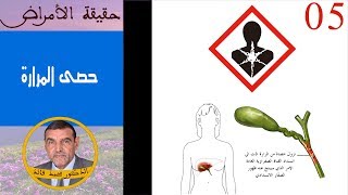 حقيقة حصى المرارة  الدكتور محمد فائد [upl. by Ohaus527]