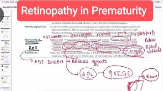 Retinopathy of prematurity Opthalmology 19 First Aid USMLE Step 1 HindiUrdu [upl. by Aninat]