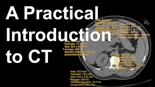 A Practical Introduction to CT [upl. by Nigam]