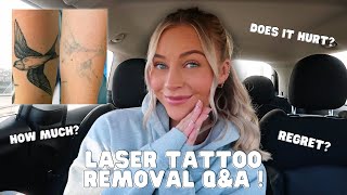 LASER TATTOO REMOVAL QampA  PAIN REGRET ANSWERING MY MOST FAQS 😬😱 [upl. by Ardiedak]