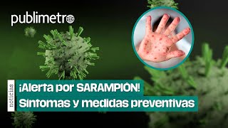 ¡Alerta por SARAMPIÓN Secretaría de Salud pide completar esquemas de vacunación [upl. by Eirrod]