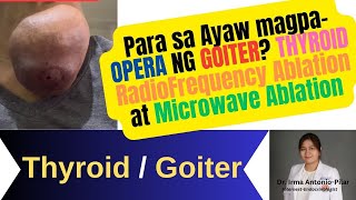 Para sa Ayaw magpa OPERA ng Goiter [upl. by Wally]