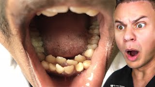 Orthodontist Reacts To The WEIRDEST Teeth On TikTok [upl. by Analad]