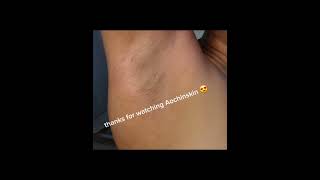 the best way to wax underarm spatherapist skincare waxing wax sugarwax waxingexpert [upl. by Odell]