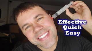 How To Remove Ear Wax Safely at Home [upl. by Grieve150]