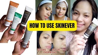 HOW TO USE SKINEVER SALICYLIC ACID [upl. by Aseel]