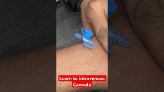 Learn to intravenous cannula  कैनुला लगाना सीखे सीखे shorts new trending SMpharmacy [upl. by Tebazile]