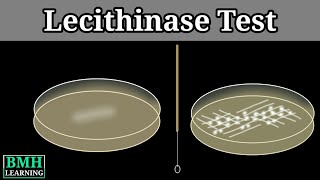 Lecithinase Test  Naglers Reaction  Clostridium Testing Method  Test For Clostridium Perfirenges [upl. by Ann]