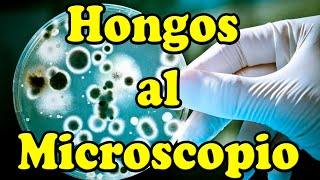 Observando HONGOS al MICROSCOPIO [upl. by Lozar]