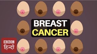 How To Recognise 12 Symptoms of Breast Cancer  BBC Duniya [upl. by Demetre333]