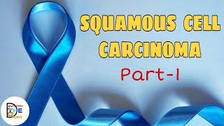 SQUAMOUS CELL CARCINOMA PART1  BENIGN AND MALIGNANT TUMORS OF ORAL CAVITY [upl. by Darej]