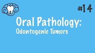 Oral Pathology  Odontogenic Tumors  INBDE ADAT [upl. by Anytsirhc]