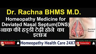 Homeopathy medicine for deviated nasal septum [upl. by Oicam482]