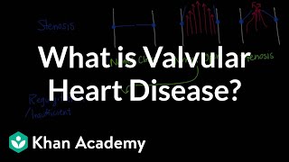 What is valvular heart disease  Circulatory System and Disease  NCLEXRN  Khan Academy [upl. by Portingale]