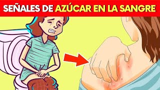 7 SEÑALES de que el AZÚCAR ESTÁ ALTO EN LA SANGRE ¿y qué hacer [upl. by Shirleen814]