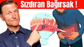 Sızdıran Bağırsakların 7 İşareti  Dr Berg Türkçe [upl. by Bernie]