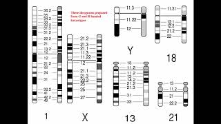 Cytogenetics II Chromosome Analysis amp Karyotypes [upl. by Arlynne750]