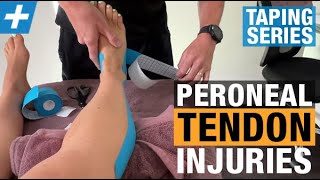 How to Tape for Peroneal Tendon Injuries [upl. by Lalib]