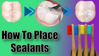 Dental Sealants  Prevent Cavities  Protective Tooth Paint [upl. by Ketti462]