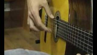 1Flamenco guitarist and focal hand dystonia Distonía focal [upl. by Obadiah621]