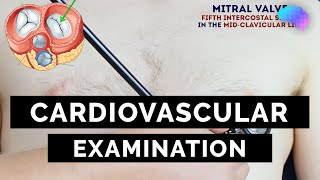 Cardiovascular Examination  OSCE Guide  UKMLA  CPSA [upl. by Onaicnop220]