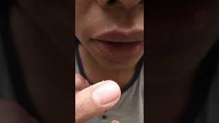 Putting salt on canker sore  mouth ulcer [upl. by Yeroc]