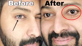 Wearing Color Lens Gone Wrong 😱 First Time Color Lens Must watch before Using  Shadhik Azeez [upl. by Hester188]