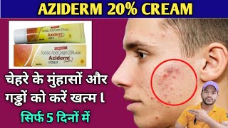 Aziderm 20 cream use dose benefits and side effects full review in hindi [upl. by Adnicul151]