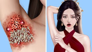 ASMR Removal Dog Ticks amp Maggot Infected Armpit  Severely Injured Animation [upl. by Esmeralda694]