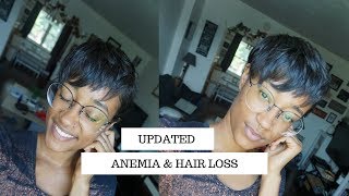 Anemia Hair Loss  Natural Hair Journey Update with Blood Builder Iron Pills and Floradix Iron [upl. by Atnad576]