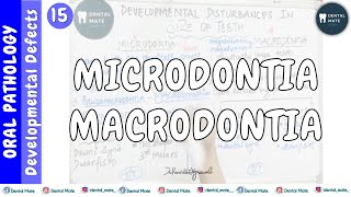 Microdontia  Macrodontia  Developmental disturbances in size of teeth  Dr Paridhi Agrawal [upl. by Mikal]