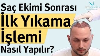 Saç Ekimi Sonrası İlk Yıkama İşlemi Nasıl Yapılır [upl. by Layod]