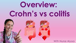 Crohns vs Colitis [upl. by Aerdnac]