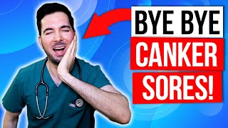 How to get rid of canker sores inside your mouth fast and treatment [upl. by Aleyam]