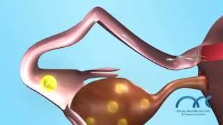 3D Human Natural Fertilization  Best fertility hospital in chennai India [upl. by Nitnelav774]