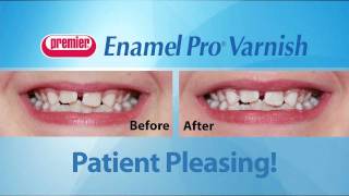 Enamel Pro Varnish [upl. by Airotal]